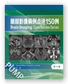 脑部影像病例点评150例（第3版）